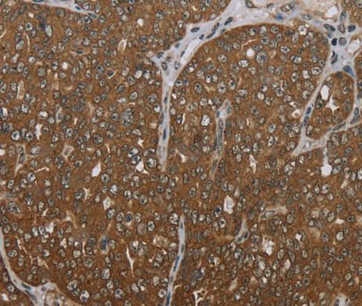 Anti-Human FOLH1B Antibody - ABMIUM