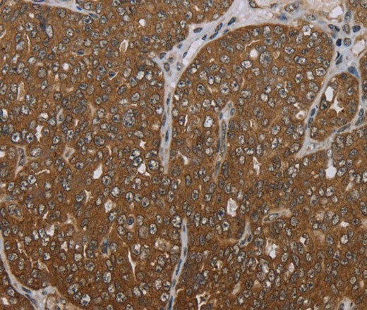Anti-Human FOLH1B Antibody - ABMIUM