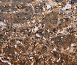 Anti-Human/Mouse/Rat FBP2 Antibody - ABMIUM