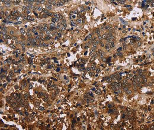 Anti-Human/Mouse/Rat FBP2 Antibody
