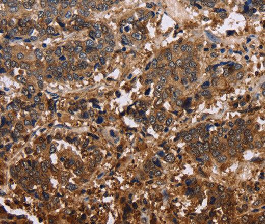 Anti-Human/Mouse/Rat FBP2 Antibody - ABMIUM
