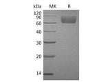 Recombinant Human FGFR3/CD333 Protein (His Tag) - ABMIUM