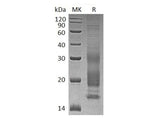 Recombinant Human VIP Protein (His Tag) - ABMIUM