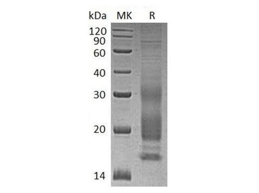 Recombinant Human VIP Protein (His Tag) - ABMIUM