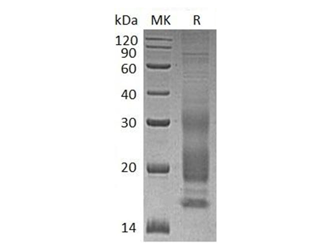 Recombinant Human VIP Protein (His Tag) - ABMIUM