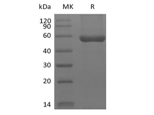 Recombinant Human HLA-A*0201 WT-1 complex Protein (C-10His) - ABMIUM