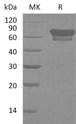 Recombinant Mouse PD-1/PDCD1 Protein (Fc Tag) - ABMIUM