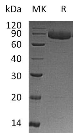 Recombinant Human IL-12 Receptor Subunit Beta1/IL-12RB1/CD212 (C-6His) - ABMIUM