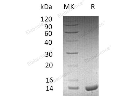 Recombinant Human Apolipoprotein C-II/APOC2 Protein (His Tag) - ABMIUM
