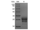 Recombinant Rhesus macaque CD160 Protein (His Tag) - ABMIUM