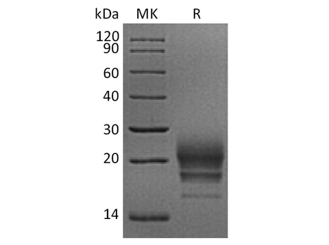 Recombinant Rhesus macaque CD160 Protein (His Tag) - ABMIUM
