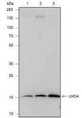 Anti-Human/Mouse LMO4 Antibody [A537]