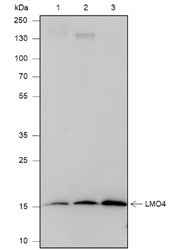 Anti-Human/Mouse LMO4 Antibody [A537] - ABMIUM