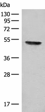 Western blot analysis of Mouse thymus tissue lysate using FGL2 Polyclonal Antibody at dilution of 1:300