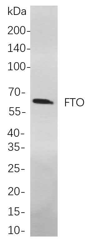 Anti-Human/Mouse/Rat FTO Antibody [B707] - ABMIUM