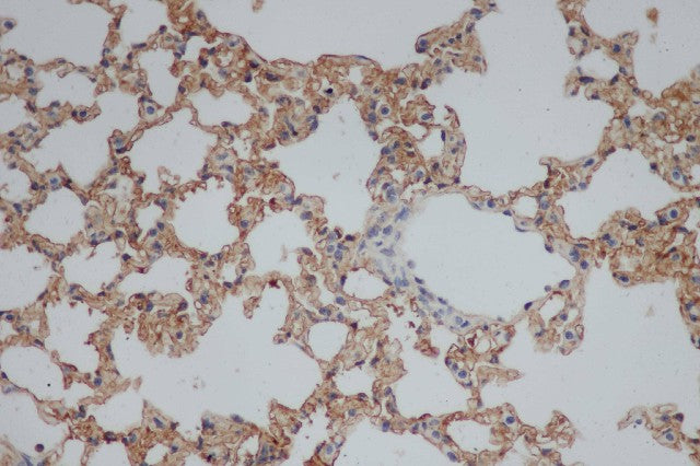 Immunohistochemistry of paraffin-embedded Rat lung using CD244 Polyclonal Antibody at dilution of 1:50
