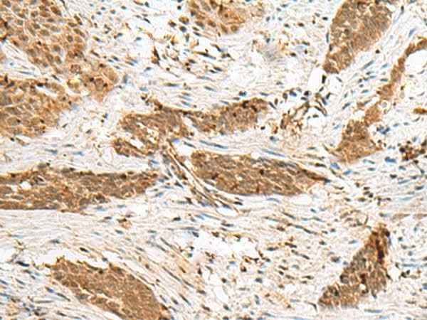 Anti-Human/Mouse/Rat NUP58 Antibody
