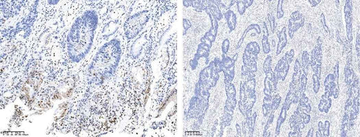 Anti-Human MAPK14 Antibody [B286] - ABMIUM