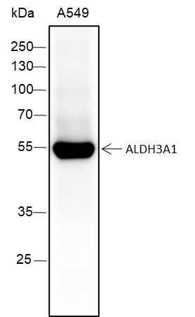 Anti-Human ALDH3A1 Antibody [A125] - ABMIUM