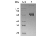 Recombinant Human ESAM Protein (aa 30-247, Fc Tag) - ABMIUM
