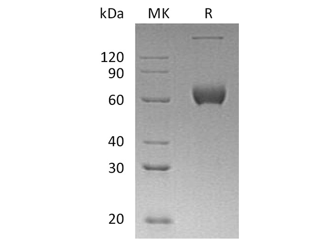 Recombinant Human ESAM Protein (aa 30-247, Fc Tag) - ABMIUM