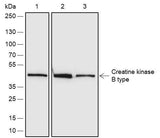 Anti-Human/Rat/Mouse Creatine kinase B type Antibody [A679]