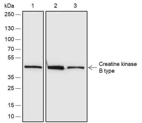 Anti-Human/Rat/Mouse Creatine kinase B type Antibody [A679] - ABMIUM