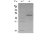> 95 % as determined by reducing SDS-PAGE.