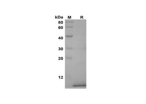SDS-PAGE analysis of Human CCL17 proteins, 2 μg/lane of Recombinant Human CCL17 proteins was resolved with SDS-PAGE under reducing conditions, showing bands at 8 kDa.