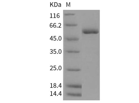 Recombinant Rat c-MPL/CD110/TPOR Protein (His Tag) - ABMIUM