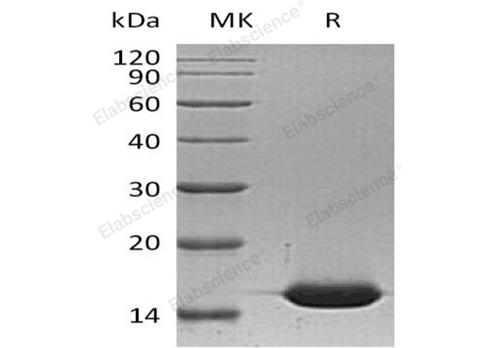 Recombinant Human L-FABP/FABP1 Protein (His Tag) - ABMIUM