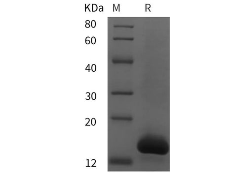 SDS-PAGE analysis of Mouse FABP5 proteins, 2 μg/lane of Recombinant Mouse FABP5 proteins was resolved with SDS-PAGE under reducing conditions, showing bands at 16 kDa.