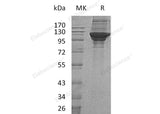 Recombinant Human KARS Protein (His Tag) - ABMIUM