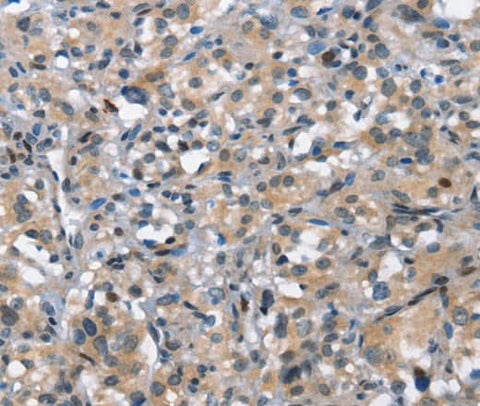Anti-Human/Mouse DDR2 Antibody - ABMIUM