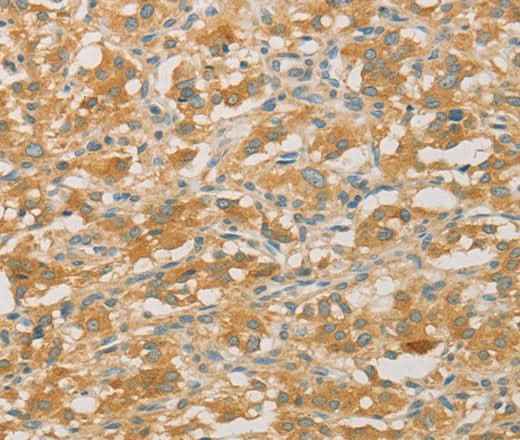 Anti-Human/Mouse/Rat PRPSAP1 Antibody