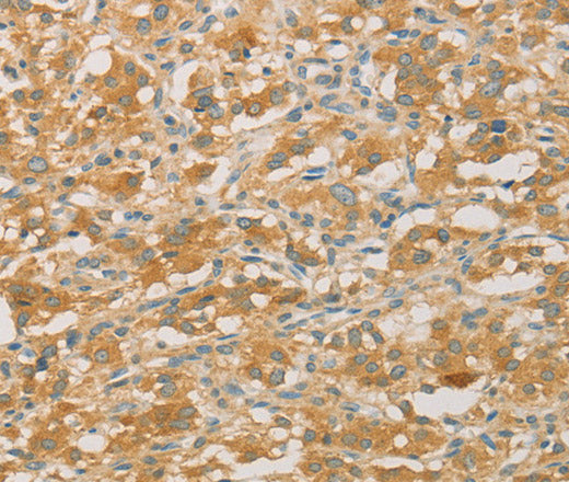 Anti-Human/Mouse/Rat PRPSAP1 Antibody - ABMIUM