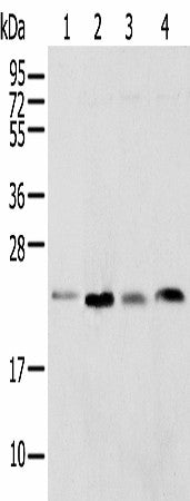 Western blot analysis of Rat lung tissue HT-29 cell Mouse adrenal gland tissue and K-562 cell using SPCS2 Polyclonal Antibody at dilution of 1:450