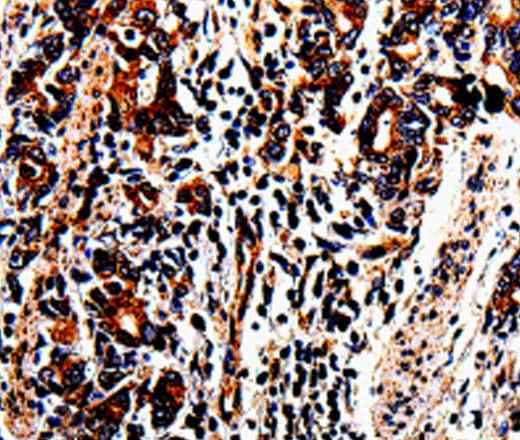 Anti-Human ACSBG2 Antibody