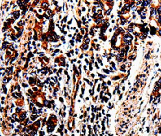 Anti-Human ACSBG2 Antibody - ABMIUM