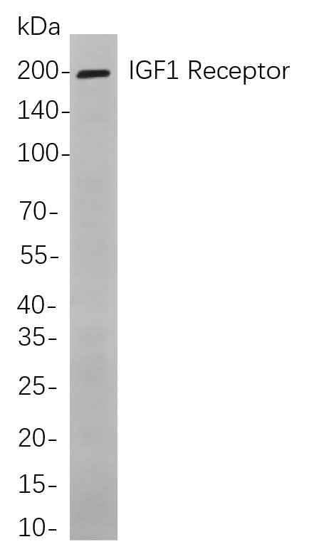 Anti-Human IGF1 Receptor Antibody [B851] - ABMIUM