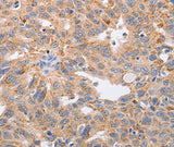 Anti-Human/Mouse/Rat PPP1CB Antibody - ABMIUM