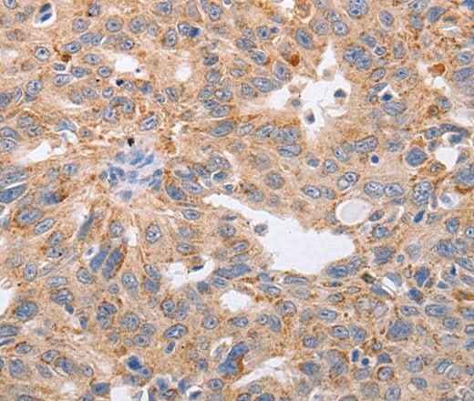 Anti-Human/Mouse/Rat PPP1CB Antibody