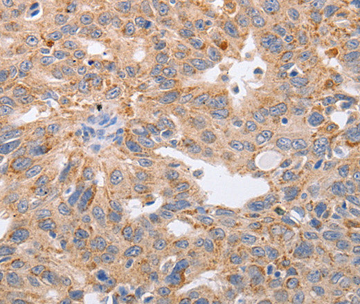 Anti-Human/Mouse/Rat PPP1CB Antibody - ABMIUM