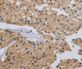 Anti-Human/Mouse/Rat HSD3B7 Antibody - ABMIUM