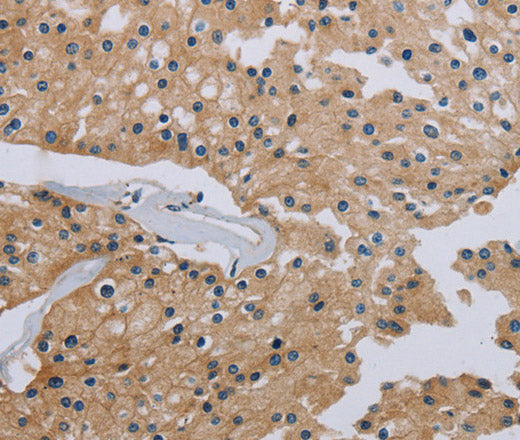 Anti-Human/Mouse/Rat HSD3B7 Antibody - ABMIUM