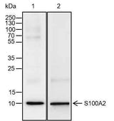 Anti-Human S100A2 Antibody [A116]