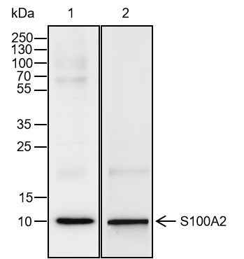 Anti-Human S100A2 Antibody [A116] - ABMIUM