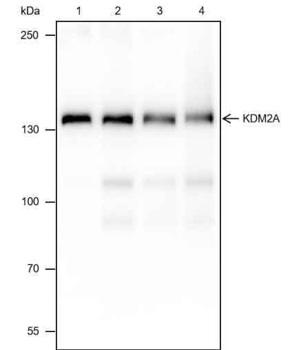 Anti-Human/Rat/Mouse KDM2A Antibody [A401] - ABMIUM