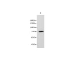 Anti-Mouse LTF Antibody - ABMIUM