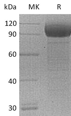 Recombinant Mouse IL1RL1/ST2 Protein (Fc Tag) - ABMIUM